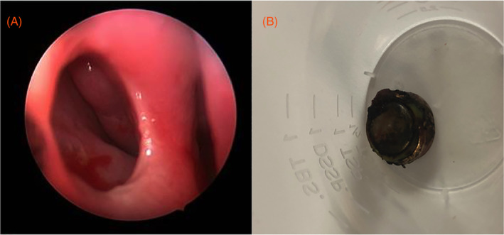 FIGURE 3