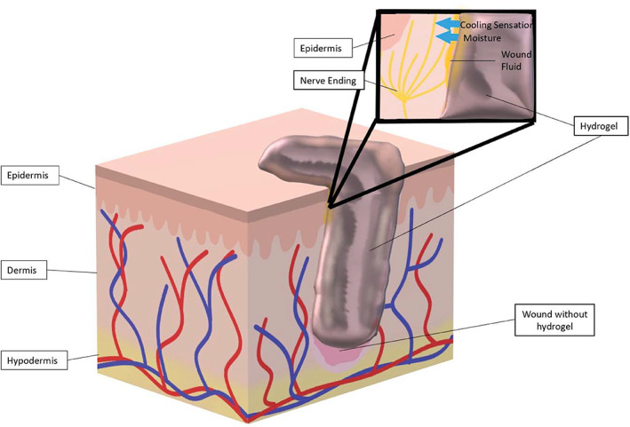 FIGURE 4