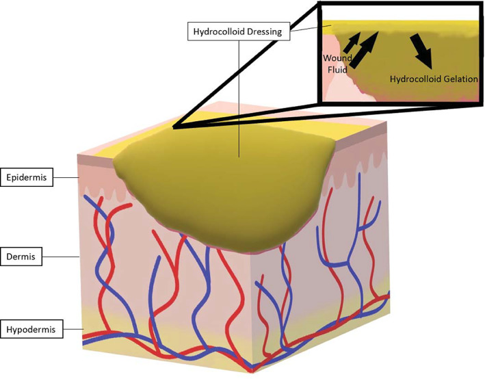 FIGURE 3