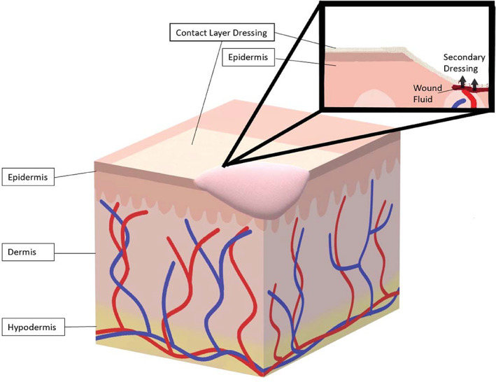 FIGURE 1