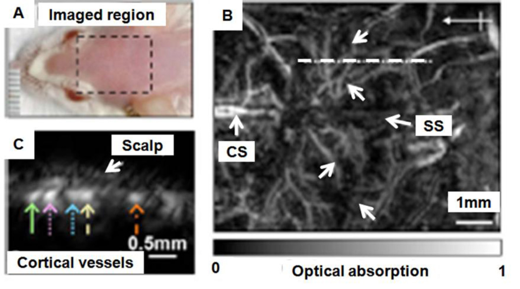 Figure 18