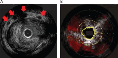 Figure 2: