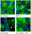 Fig. 11