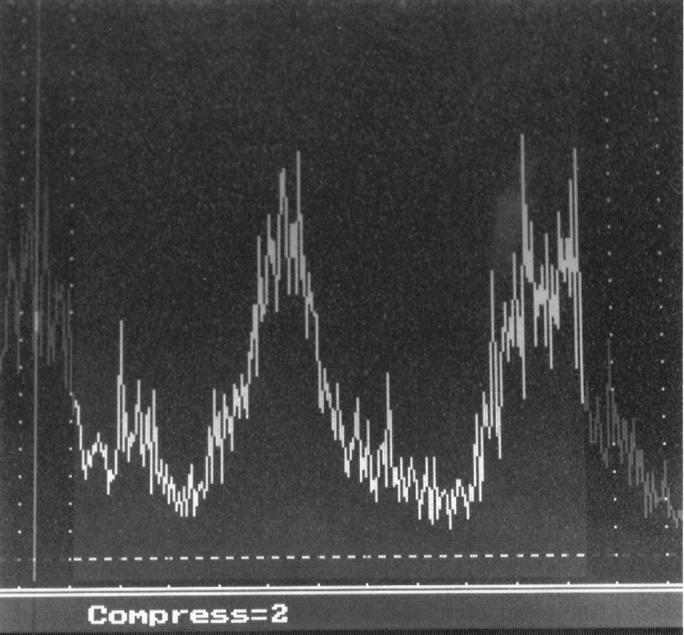 Figure 3  