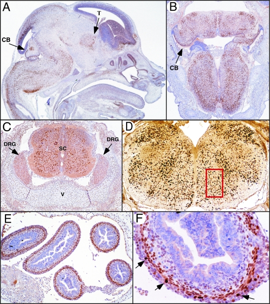 Figure 1-4275