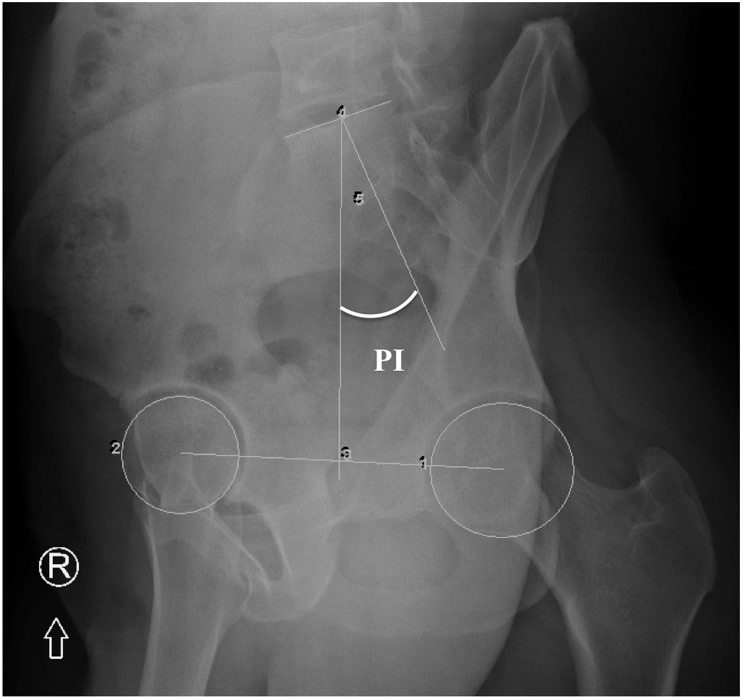 Fig. 2