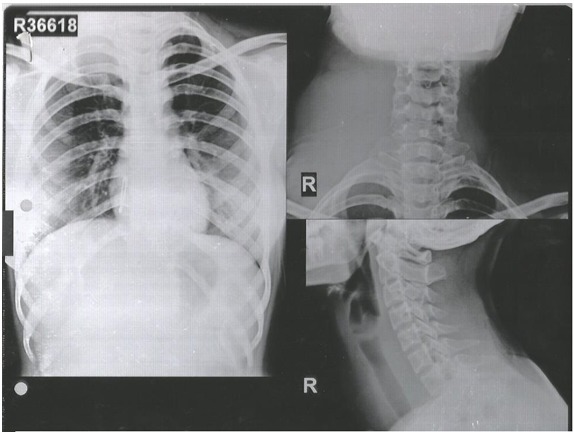 Fig 2