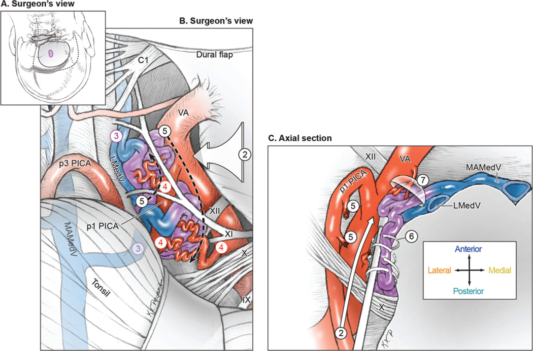 FIG. 4