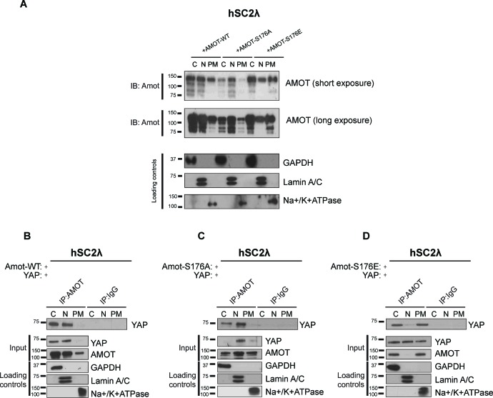 Figure 4—figure supplement 1.