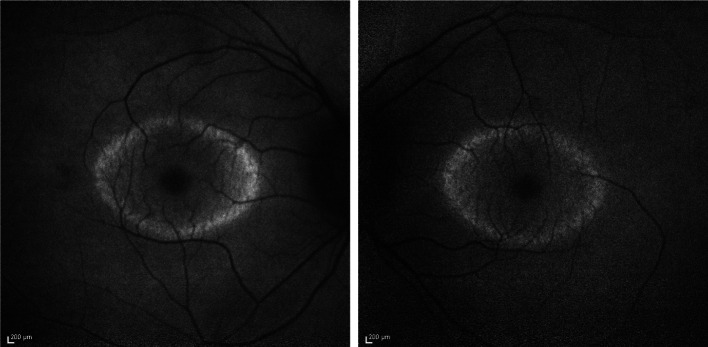 Fig. 3