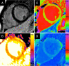 Fig. 4