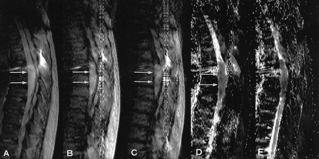 fig 2.