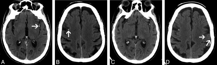 Fig 2.