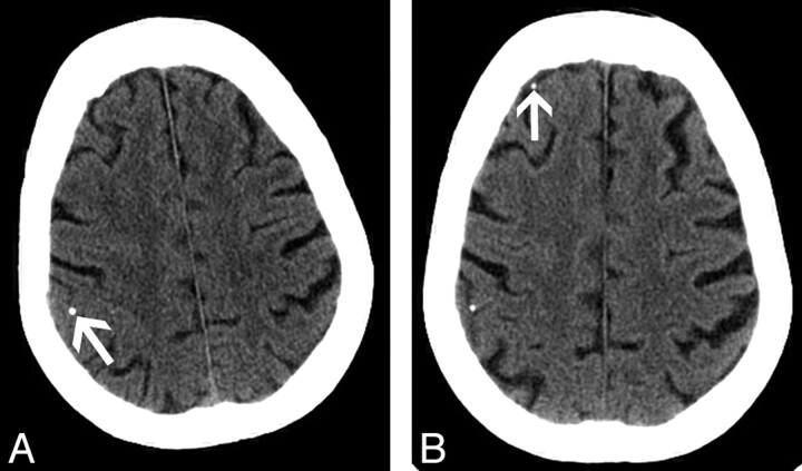 Fig 4.