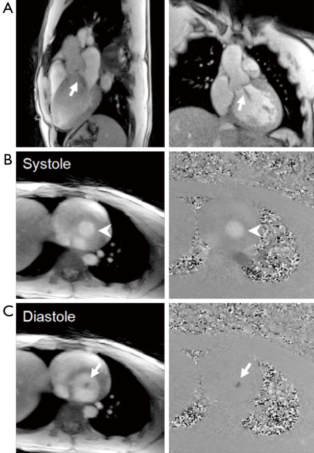 Figure 15