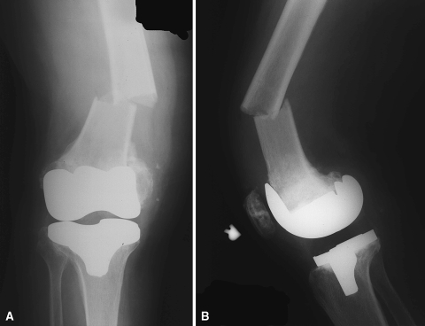 Fig. 1A–B