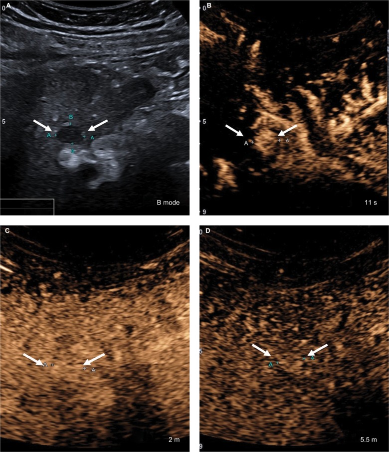 Figure 17