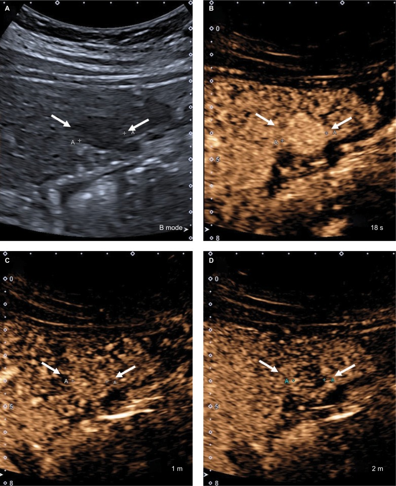 Figure 16