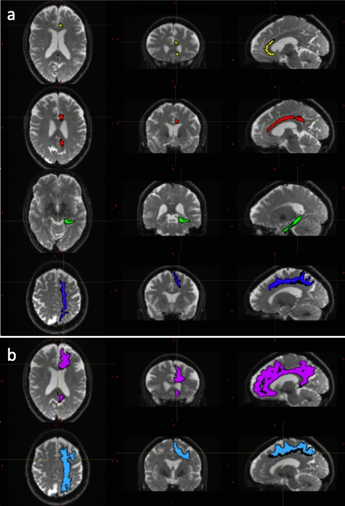 Fig. 2