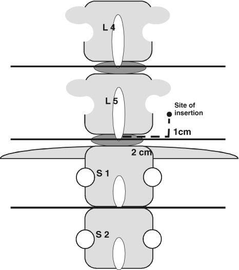 Fig. 1