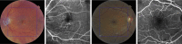 Fig. 6.