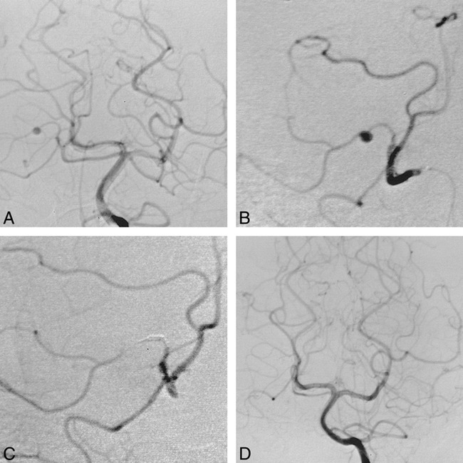 fig 2.