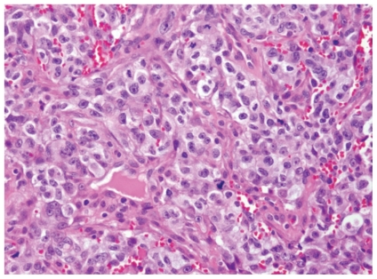 FIGURE 3