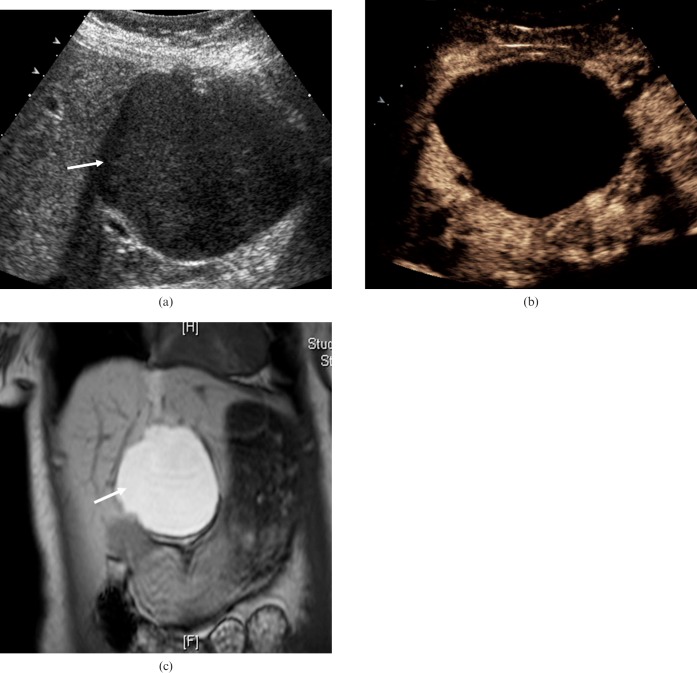 Figure 10