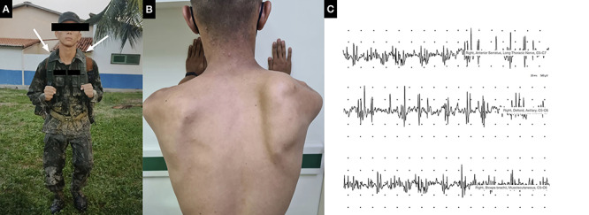 Figure 1. 