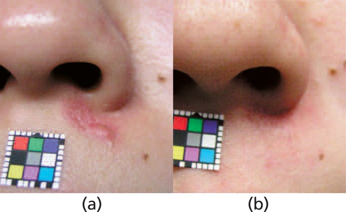 Figure 4: