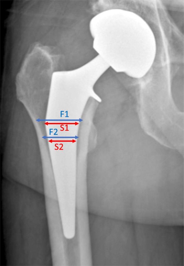 Fig. 2