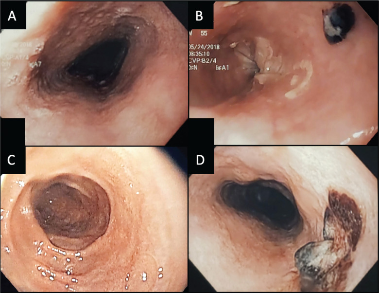 Figure 2: