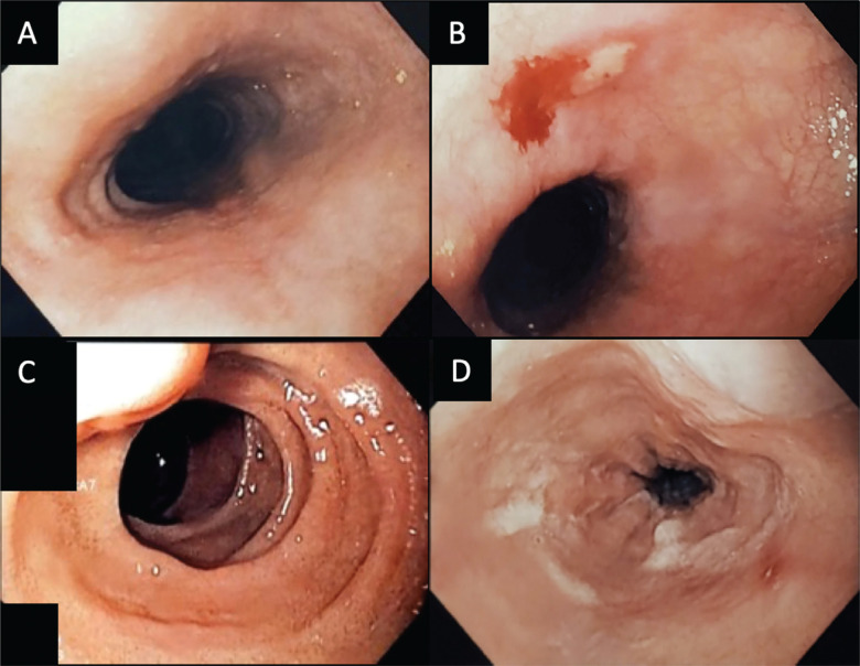 Figure 3: