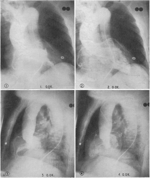 Fig. VII