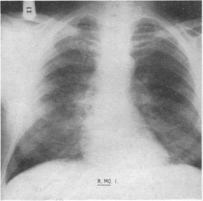 Fig. II