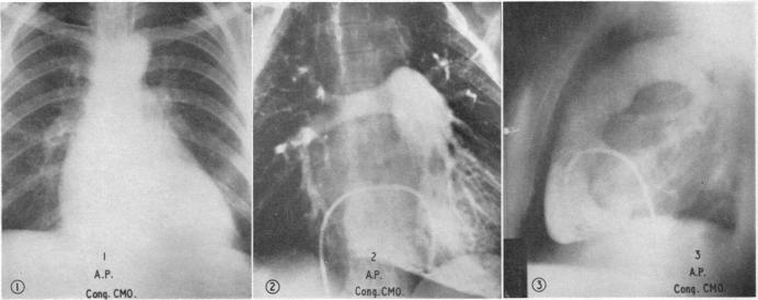 Fig. I(1)-(3)