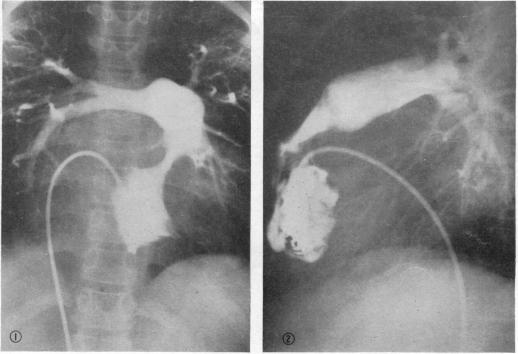 Fig. III