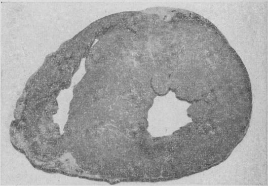 Fig. 14