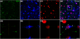 Figure 11.