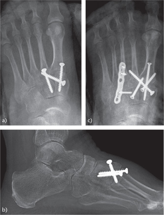 Fig. 14