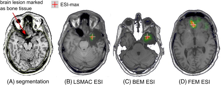 Fig. 4