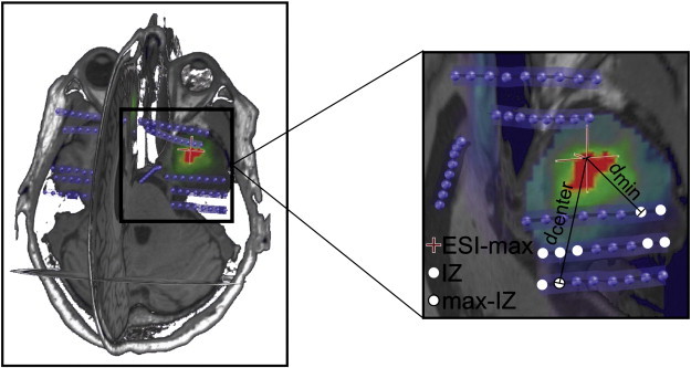 Fig. 1