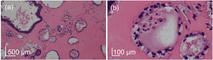 Fig. 11.