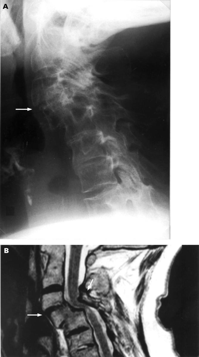 Figure 4  