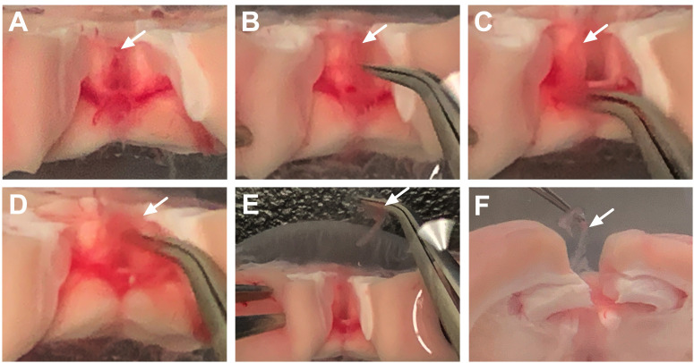 Figure 4.