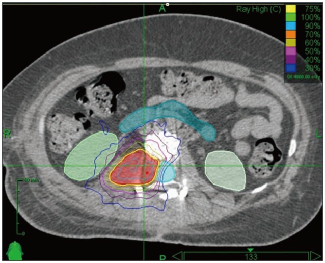 Fig. 4