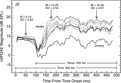 Figure 11