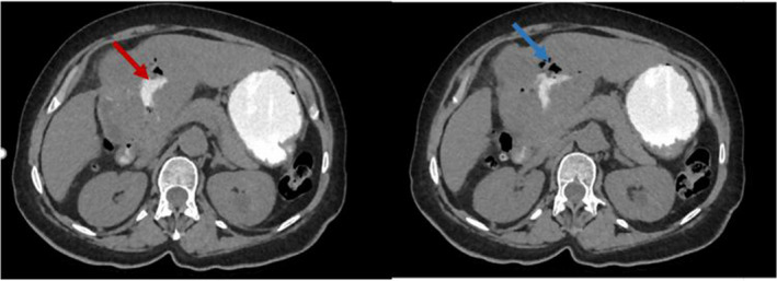 FIGURE 4