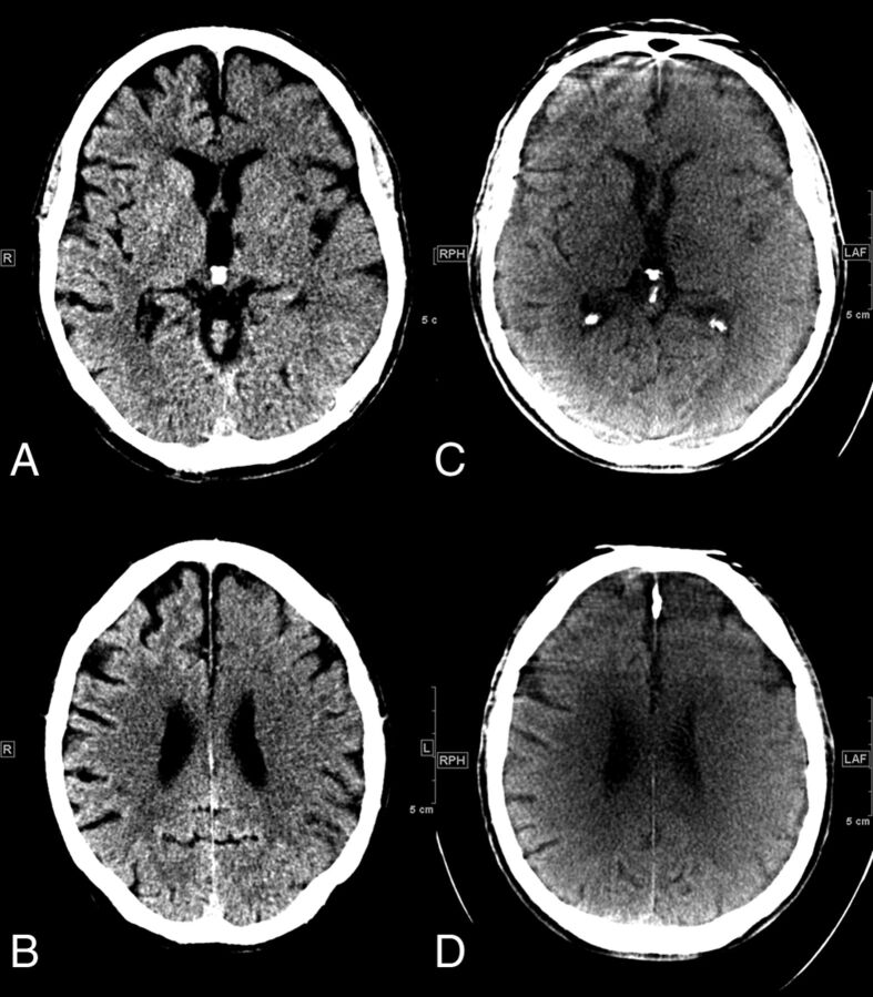 Fig 2.