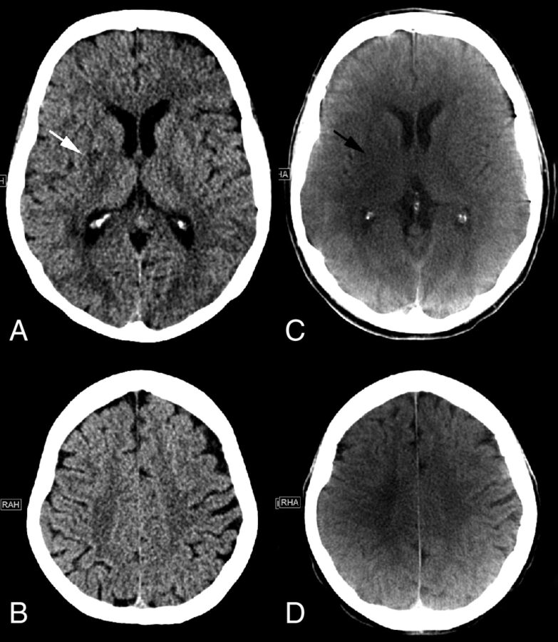 Fig 1.